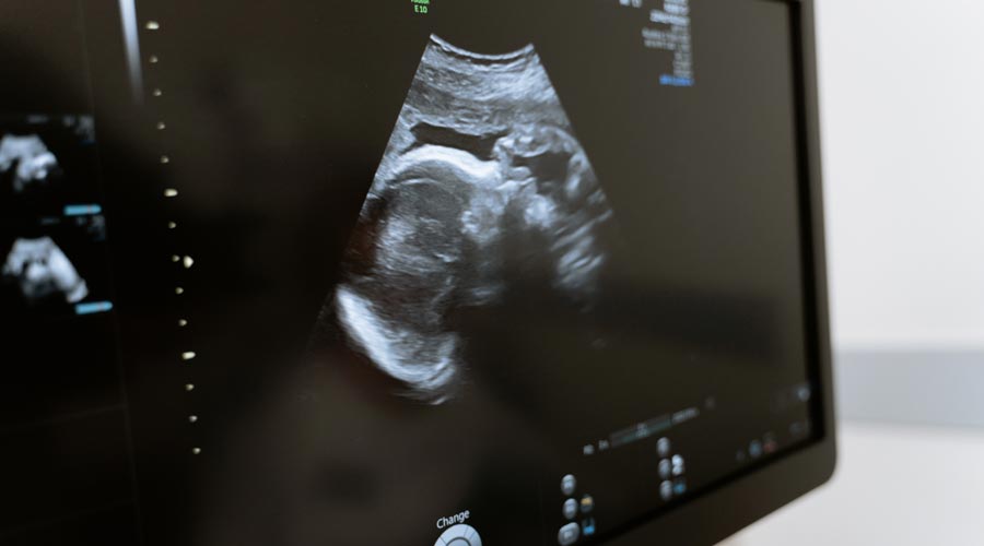 Fruchtbare Tage und Eisprung berechnen